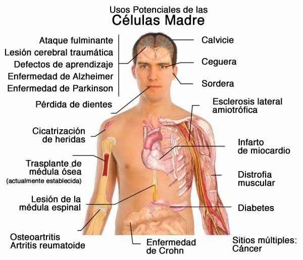 tratamientos-celulas-madre